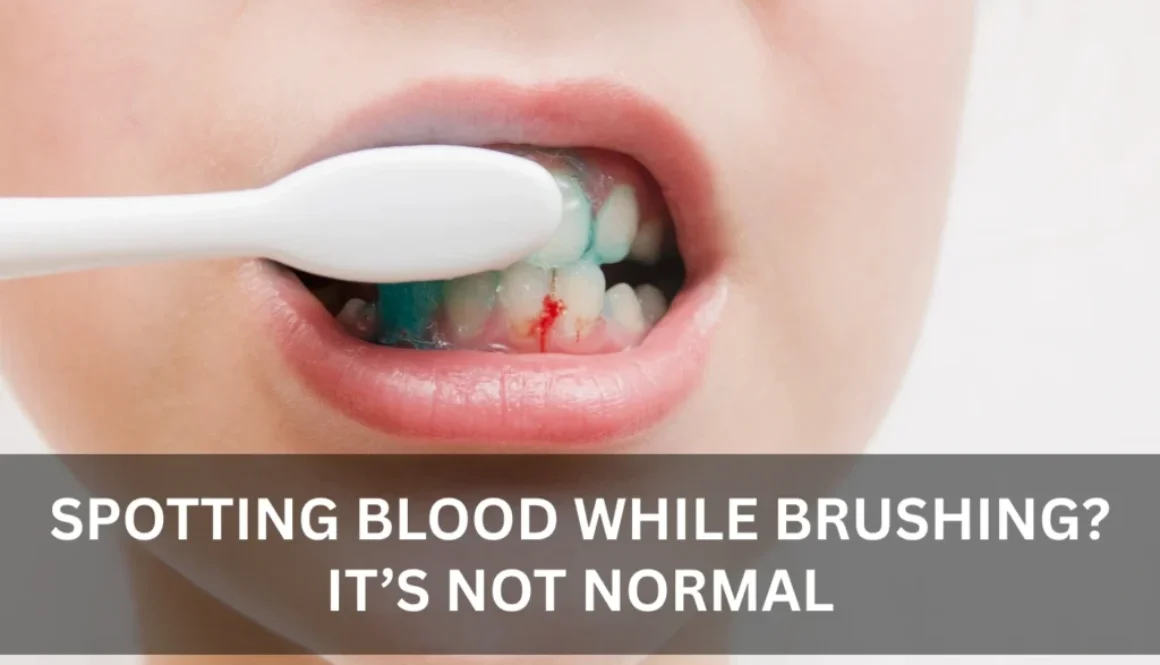 Gum Disease Treatment in Bur Dubai