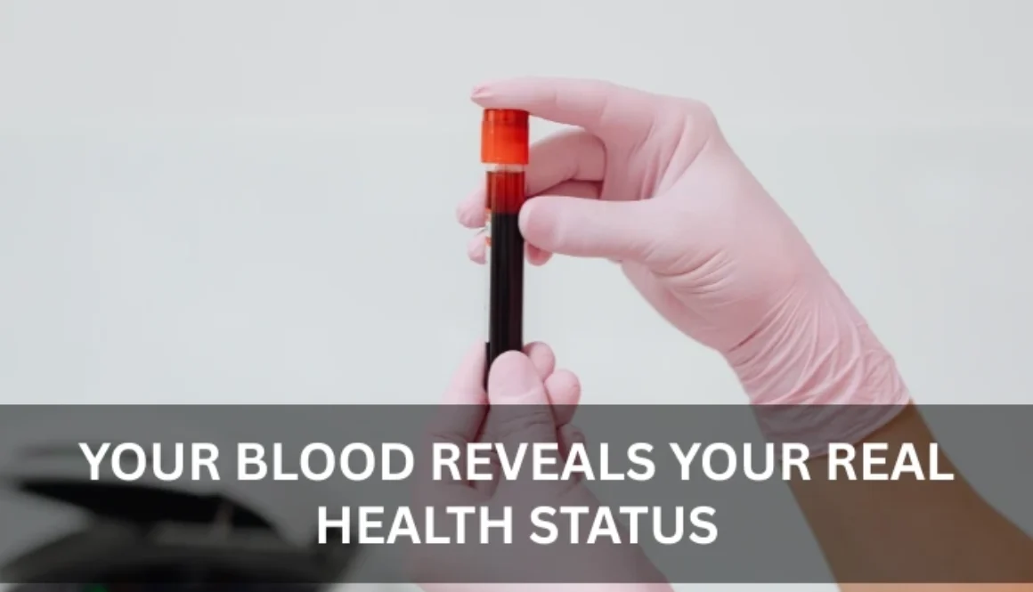 blood test in Bur Dubai
