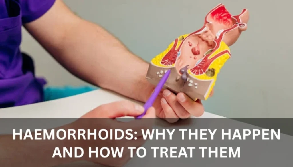 Hemorrhoids treatment bur dubai