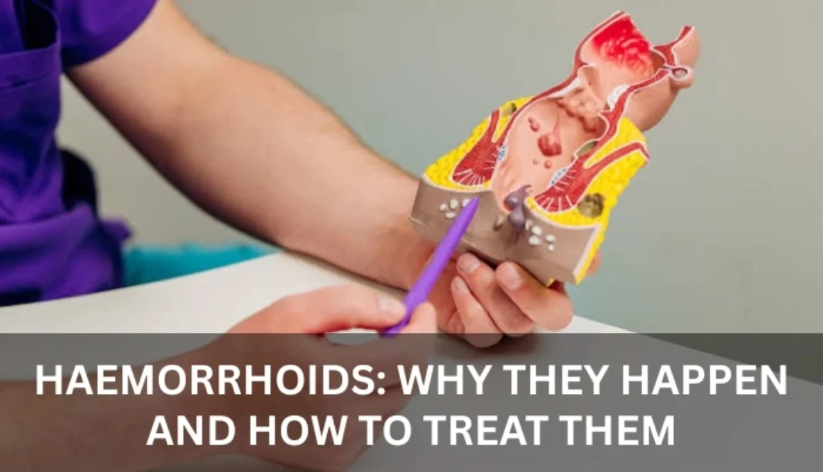 Hemorrhoids treatment bur dubai