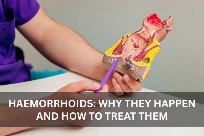Hemorrhoids treatment bur dubai
